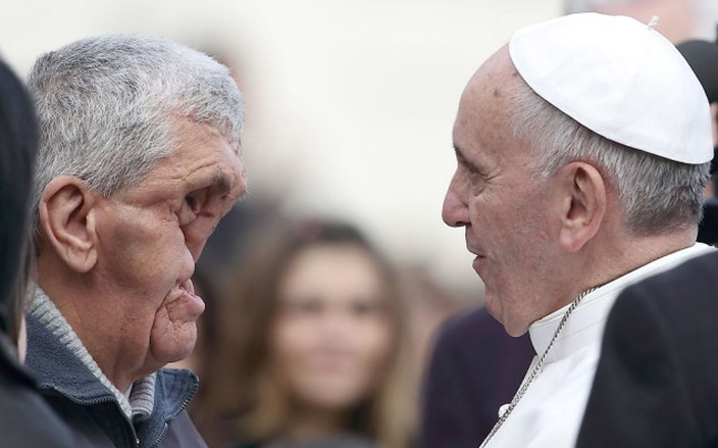 Ο πάπας Φραγκίσκος αγκάλιασε έναν άνδρα χωρίς πρόσωπο (Προσοχή σκληρές εικόνες) - Φωτογραφία 2