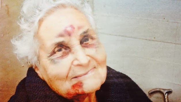 H φωτογραφία από το νησί της Κεφαλονιάς που ΣΥΓΚΛΟΝΙΖΕΙ - Η ηλικιωμένη που πληγώθηκε από το σεισμό και χαμογελά με ελπίδα - Φωτογραφία 2