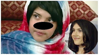 Το κορίτσι από το Αφγανιστάν που του έκοψαν τη μύτη και τα αυτιά, χαμογελάει ξανά! - Φωτογραφία 1