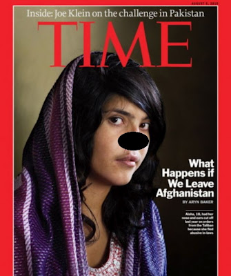 Το κορίτσι από το Αφγανιστάν που του έκοψαν τη μύτη και τα αυτιά, χαμογελάει ξανά! - Φωτογραφία 2