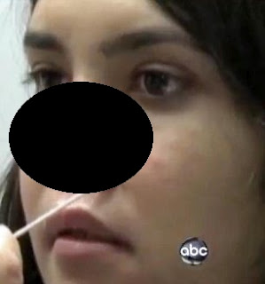 Το κορίτσι από το Αφγανιστάν που του έκοψαν τη μύτη και τα αυτιά, χαμογελάει ξανά! - Φωτογραφία 3