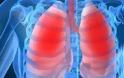 Η πνευμονία θανατηφόρα για το 70% των παιδιών κάτω των 5 χρονών
