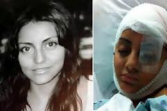 Αποζημίωση $18.000.000 σε γυναίκα κομπάρσο