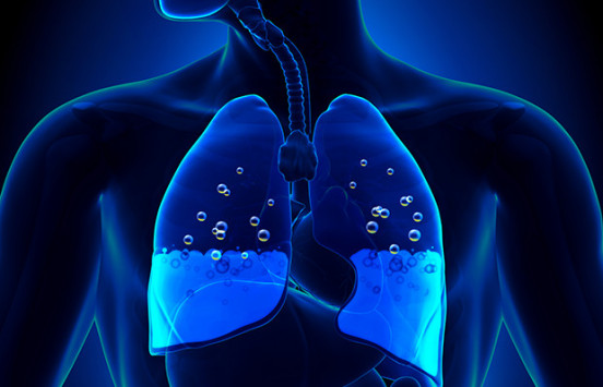 Τα «μικρά» συμπτώματα που δείχνουν συσσώρευση υγρού στον πνεύμονα - Φωτογραφία 1