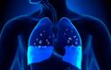 Τα «μικρά» συμπτώματα που δείχνουν συσσώρευση υγρού στον πνεύμονα