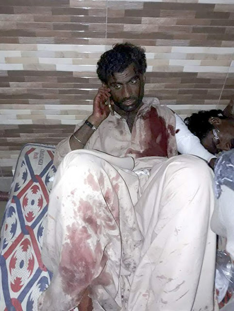 Προσοχη! Πολύ σκληρές εικόνες από την επίθεση στο Πακιστάν - Ο ISIS ανέλαβε την ευθύνη - Φωτογραφία 4