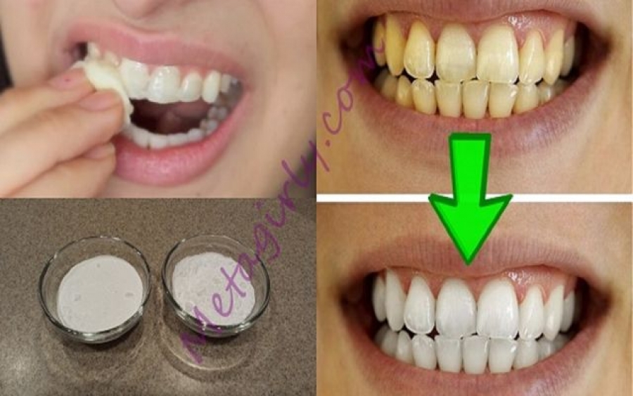 Εγγυημένο! Πώς να λευκάνετε τα δόντια σας σε λιγότερο από 2 λεπτά! - Φωτογραφία 1