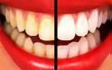 Δείτε πως θα αποκτήσετε το πιο λαμπερό χαμόγελο! 9 θαυματουργές συνταγές για κάτασπρα δόντια!