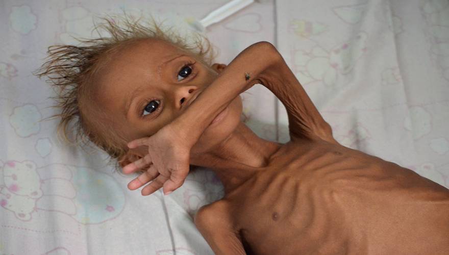 Έκκληση του ΟΗΕ για την Υεμένη: «Στα πρόθυρα λιμού η χώρα» - Φωτογραφία 1