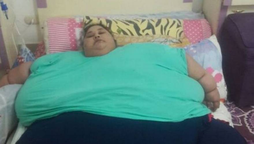 Επιτυχημένη η χειρουργική επέμβαση της γυναίκας που ζύγιζε 500 κιλά - Φωτογραφία 1