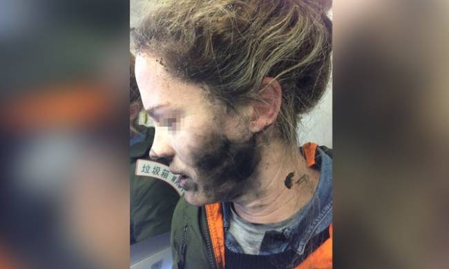 Τρομακτικτό ατύχημα: Εξερράγησαν τα ακουστικά στο πρόσωπό της εν μέσω πτήσ - Φωτογραφία 1