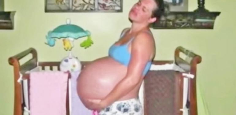 Έγκυος περιμένει δίδυμα άλλα η κοιλία της δεν σταματάει να μεγαλώνει - Ούτε ο γυναικολόγος της δεν φανταζόταν τι συνέβαινε... - Φωτογραφία 1