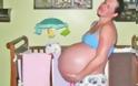 Έγκυος περιμένει δίδυμα άλλα η κοιλία της δεν σταματάει να μεγαλώνει - Ούτε ο γυναικολόγος της δεν φανταζόταν τι συνέβαινε... - Φωτογραφία 1