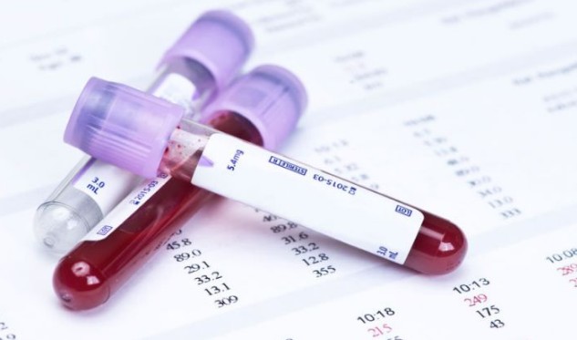 Πειραματικό τεστ αίματος υπόσχεται έγκαιρη διάγνωση του αυτισμού - Φωτογραφία 1