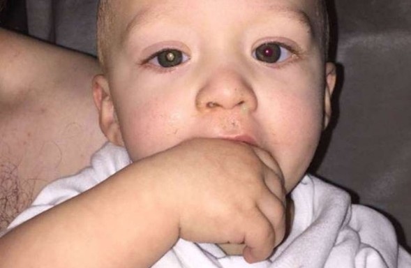 Μπορείτε να διακρίνετε τον καρκίνο στο μάτι αυτού του παιδιού; [photos] - Φωτογραφία 1