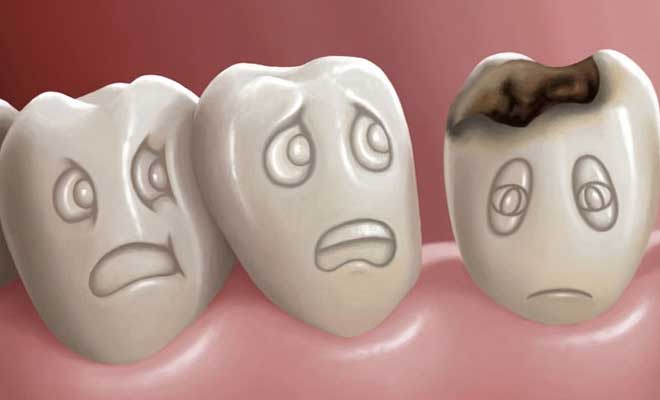 Μεγάλη προσοχή: Χαλασμένα δόντια; Ποιους κινδύνους κρύβουν για την υγεία - Φωτογραφία 1