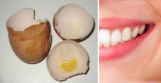 Πώς να απαλλαγείτε από την τερηδόνα των δοντιών χρησιμοποιώντας τσόφλια αυγών; - Φωτογραφία 1
