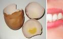 Πώς να απαλλαγείτε από την τερηδόνα των δοντιών χρησιμοποιώντας τσόφλια αυγών;