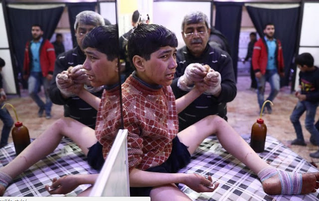 Φρίκη στη Συρία με 80 νεκρούς από χημικά - Βομβάρδισαν και το νοσοκομείο - Φωτογραφία 2