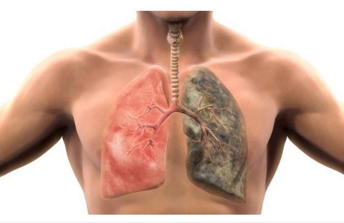Αυτές είναι οι τροφές που καθαρίζουν τους πνεύμονες από τη νικοτίνη - Φωτογραφία 1
