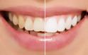 Πιο λευκά δόντια: Κάντε μπουκώματα με αυτό το φυσικό διάλυμα... [video]