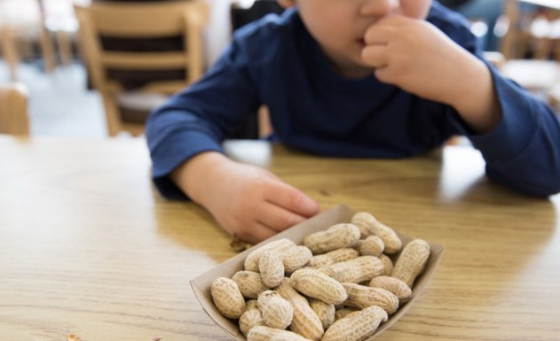 Ποιες τροφές είναι υπεύθυνες για τις παιδικές αλλεργίες - Φωτογραφία 1