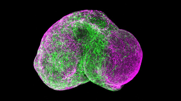 Αυτισμός: Δημιούργησαν «μίνι-εγκεφάλους» σε εργαστήριο και «διόρθωσαν» τα προβληματικά κύτταρα - Φωτογραφία 1