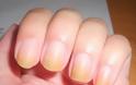 Νύχια που κιτρινίζουν: Αυτές είναι οι 4 βασικές αιτίες