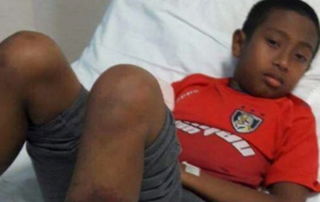 Μαστίγωσαν μέχρι θανάτου 11χρονο με λάστιχο στο σχολείο του - Φωτογραφία 1