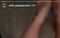 Ειρήνη Παπαδοπούλου: Σοκάρουν τα σημάδια στα πόδια της μετά το Survivor! (pics) - Φωτογραφία 4