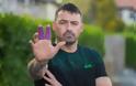 Ένα ακόμη iphone 7 εξερράγη στα χέρια του ιδιοκτήτη του τραυματίζοντας τα δάχτυλα του