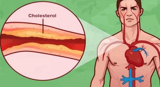 8 εκπληκτικοί τρόποι για την καταπολέμηση της χοληστερόλης και της υψηλής αρτηριακής πίεσης - Φωτογραφία 1