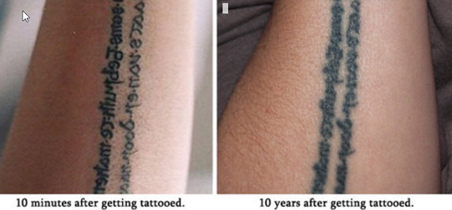ΣΟΚ! Δείτε γιατί δεν πρέπει να κάνετε τατουάζ! - Φωτογραφία 6