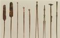 Γιατί τα Ιατρικά Εργαλεία των Αρχαίων Ελλήνων είναι Ίδια με τα Σημερινά! - Φωτογραφία 2