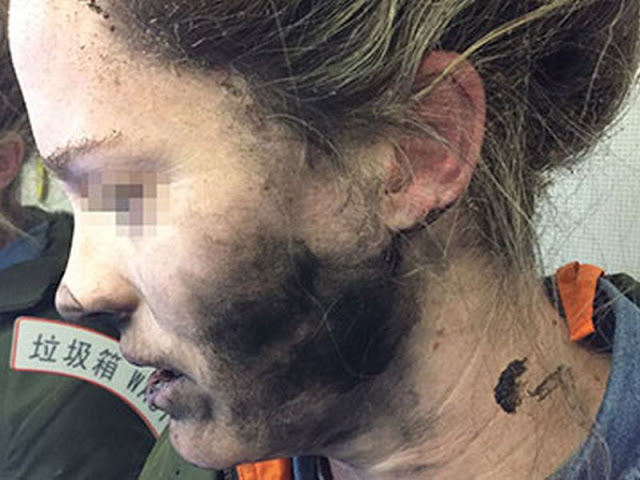 Η Apple αρνήθηκε να αποζημιώσει την γυναίκα που τραυματίστηκε από έκρηξη των ακουστικών που πουλά η ίδια - Φωτογραφία 1