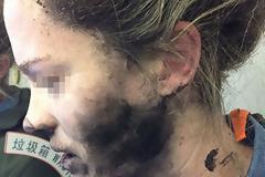 Η Apple αρνήθηκε να αποζημιώσει την γυναίκα που τραυματίστηκε από έκρηξη των ακουστικών που πουλά η ίδια