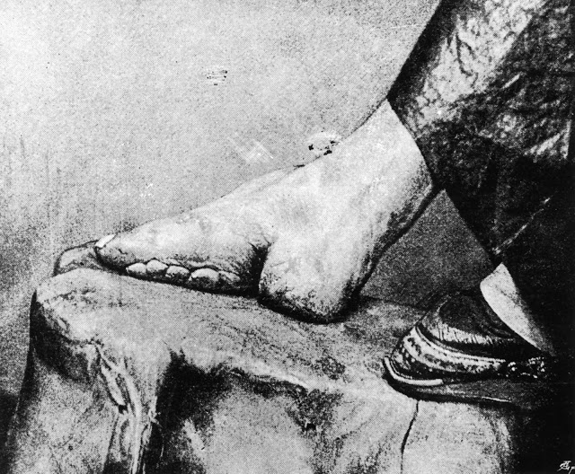 Τα πόδια του λωτού: Το απάνθρωπο κινέζικο έθιμο - Ο πραγματικός λόγος που οι Κινέζες έδεναν τα πόδια τους - Φωτογραφία 4
