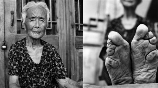 Τα πόδια του λωτού: Το απάνθρωπο κινέζικο έθιμο - Ο πραγματικός λόγος που οι Κινέζες έδεναν τα πόδια τους - Φωτογραφία 5