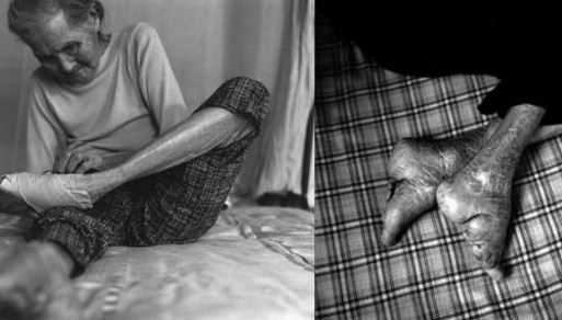 Τα πόδια του λωτού: Το απάνθρωπο κινέζικο έθιμο - Ο πραγματικός λόγος που οι Κινέζες έδεναν τα πόδια τους - Φωτογραφία 6