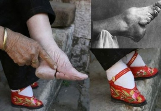 Τα πόδια του λωτού: Το απάνθρωπο κινέζικο έθιμο - Ο πραγματικός λόγος που οι Κινέζες έδεναν τα πόδια τους - Φωτογραφία 8