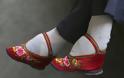 Τα πόδια του λωτού: Το απάνθρωπο κινέζικο έθιμο - Ο πραγματικός λόγος που οι Κινέζες έδεναν τα πόδια τους