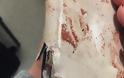 Μια γυναίκα γλύτωσε από το iPhone της στην τρομοκρατική επίθεση στο Μάντσεστερ - Φωτογραφία 3