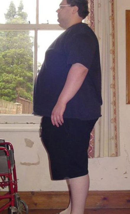 Άνδρας 210 κιλών έγινε κούκλος σε 18 μήνες! Δεν θα πιστεύετε στα μάτια σας! [photos] - Φωτογραφία 3