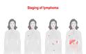 Λέμφωμα – καρκίνος: Προσοχή στα «αθώα» συμπτώματα – Πού να ψηλαφήσετε για την αυτοεξέταση [video] - Φωτογραφία 2
