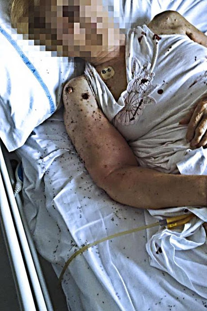 Εικόνες φρίκης: Ηλικιωμένη γεμάτη μυρμήγκια εγκαταλείφθηκε σε νοσοκομείο - Τι λέει ο διευθυντής του νοσοκομείου - Φωτογραφία 2