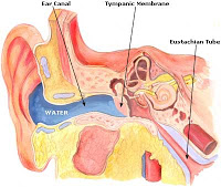 Τι να κάνετε αν μπει νερό στο αυτί σας - Φωτογραφία 2