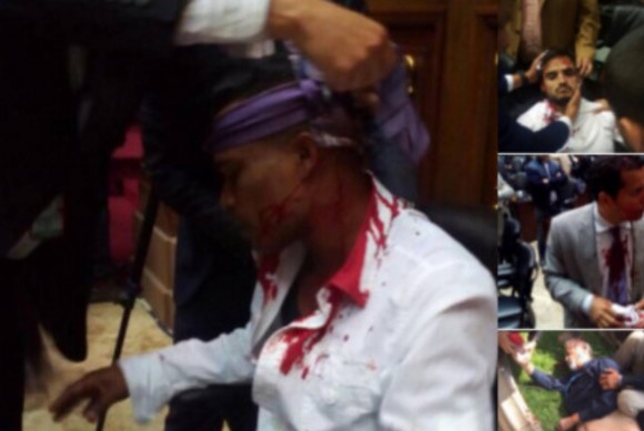 Το απόλυτο Χάος! Υποστηρικτές του Μαδούρο μπούκαραν με ρόπαλα στο Κοινοβούλιο - Τραυματίες βουλευτές [photos] - Φωτογραφία 1