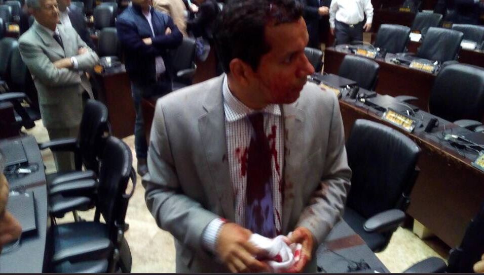 Bενεζουέλα: Αιματηρή εισβολή οπαδών του Μαδούρο στο κοινοβούλιο - Φωτογραφία 2