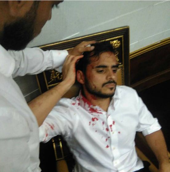 Bενεζουέλα: Αιματηρή εισβολή οπαδών του Μαδούρο στο κοινοβούλιο - Φωτογραφία 3