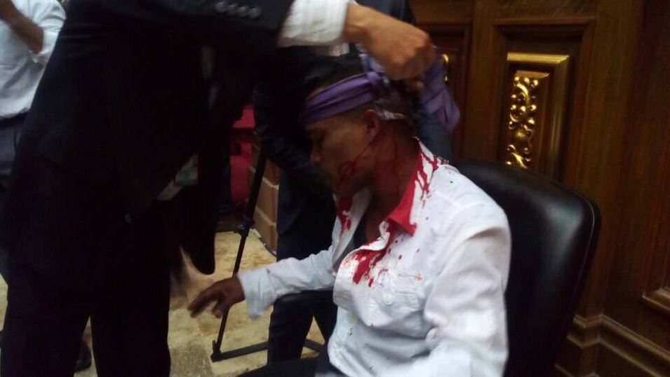 Bενεζουέλα: Αιματηρή εισβολή οπαδών του Μαδούρο στο κοινοβούλιο - Φωτογραφία 5